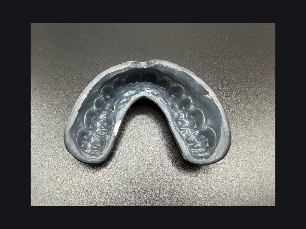 Sports Mouthguard — 5.0 mm