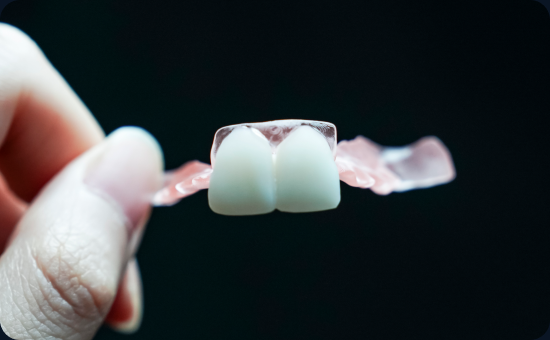 Digital Soft Denture — 3D-printed flexible partial denture