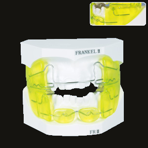 Frankel II