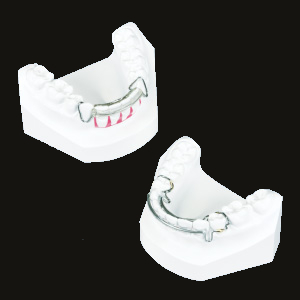 1.Spring Retainer (above) 2.New Type Spring Retainer (below)