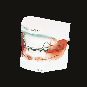 Bimler C