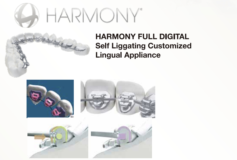 HARMONY