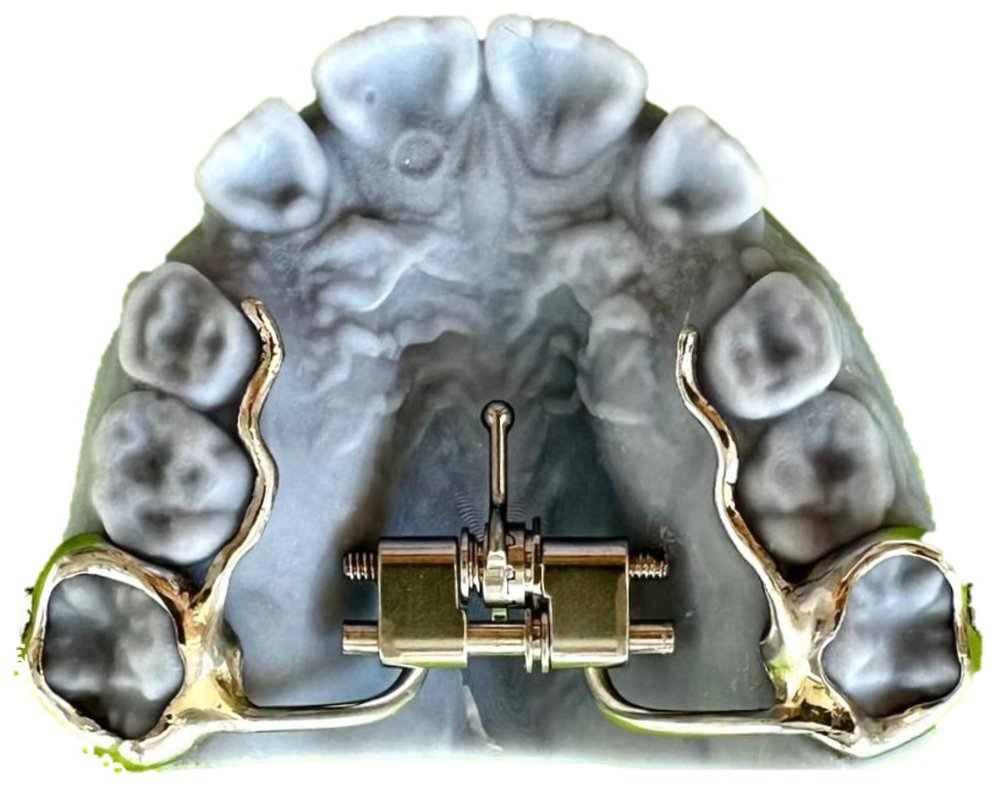 Keyless Expander