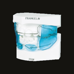 Frankel IV
