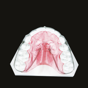 QCM Retainer