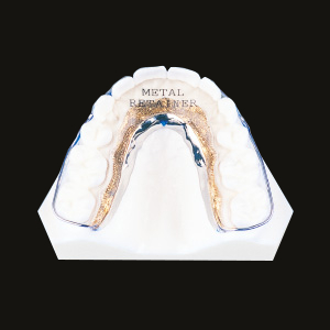 Metal Retainer